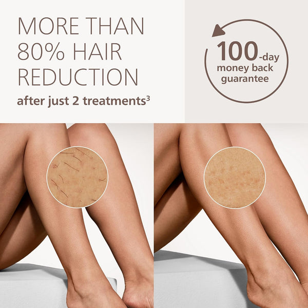 Philips Lumea 9000 IPL Hair Removal DeviceBRI984/00